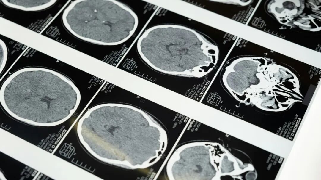 AI 已经医学影像及癌症检测中超越人类专家 配图 3