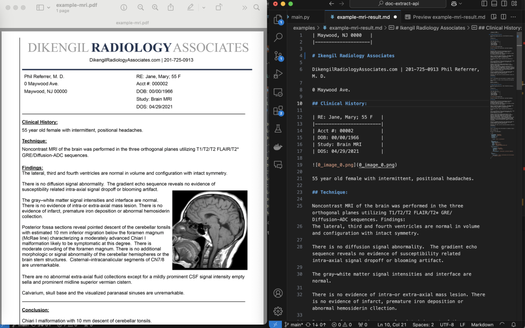 PDF Extract API：OCR文档提取与解析工具，Python+自然语言实现