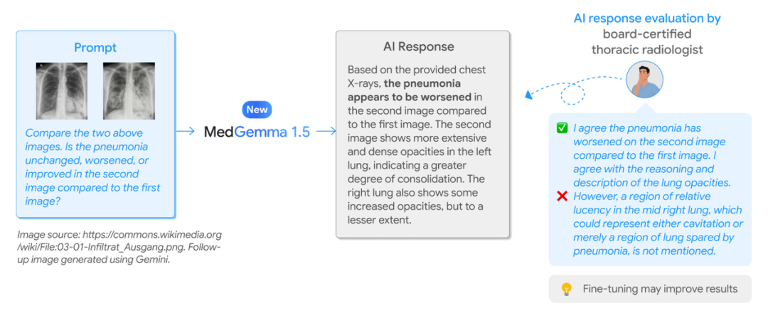 利用 MedGemma 1.5 与 MedASR 构建下一代医疗应用 配图 5