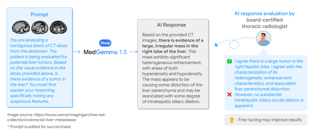 利用 MedGemma 1.5 与 MedASR 构建下一代医疗应用 配图 3